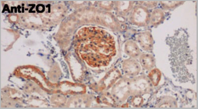 product-image-AAA13861_IHC11.jpg