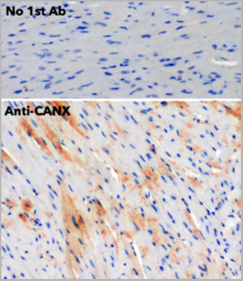 product-image-AAA13872_IHC4.jpg