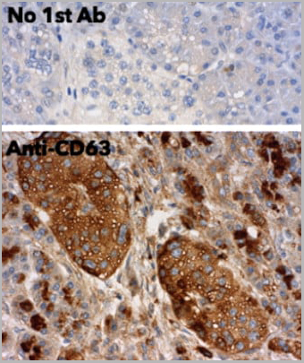 product-image-AAA13873_IHC5.jpg