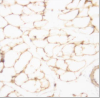 product-image-AAA14070_IHC2.jpg