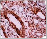 product-image-AAA14072_IHC2.jpg