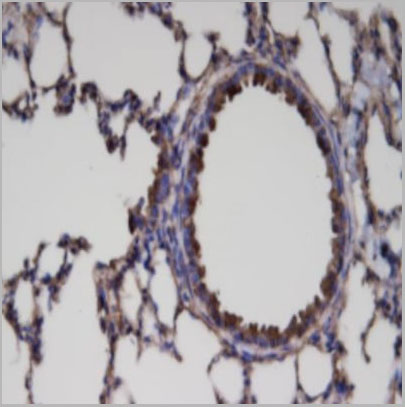 product-image-AAA14073_IHC2.jpg