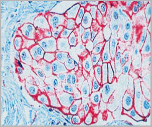 product-image-AAA14075_IHC.jpg