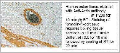 product-image-AAA14079_IHC3.jpg