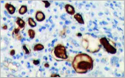 product-image-AAA14080_IHC2.jpg