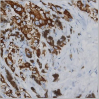 product-image-AAA14081_IHC4.jpg