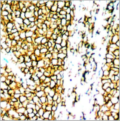 product-image-AAA14082_IHC2.jpg