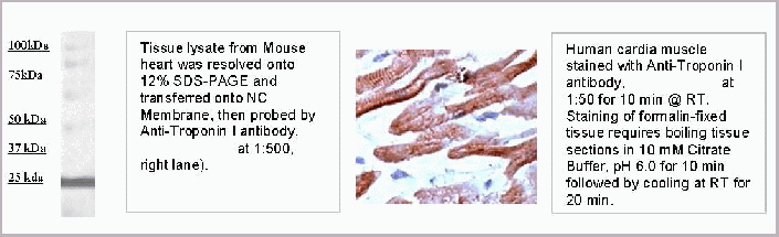 product-image-AAA14092_APP.gif