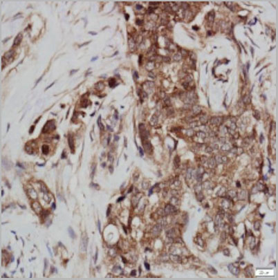 product-image-AAA14095_IHC3.jpg