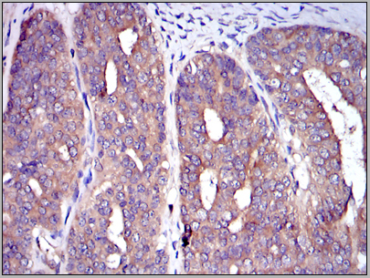 product-image-AAA14105_IHC6.jpg
