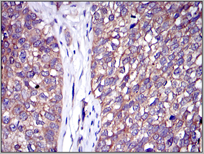 product-image-AAA14105_IHC7.jpg