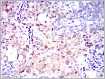product-image-AAA14112_IHC3.jpg