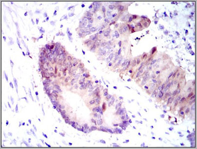 product-image-AAA14112_IHC4.jpg