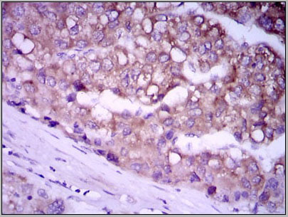 product-image-AAA14118_IHC4.jpg
