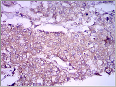 product-image-AAA14118_IHC6.jpg