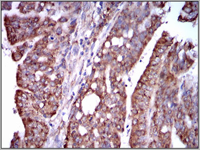 product-image-AAA14124_IHC6.jpg