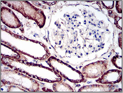 product-image-AAA14153_IHC6.jpg