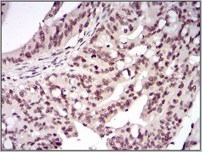 product-image-AAA14155_IHC6.jpg