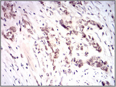 product-image-AAA14162_IHC3.jpg