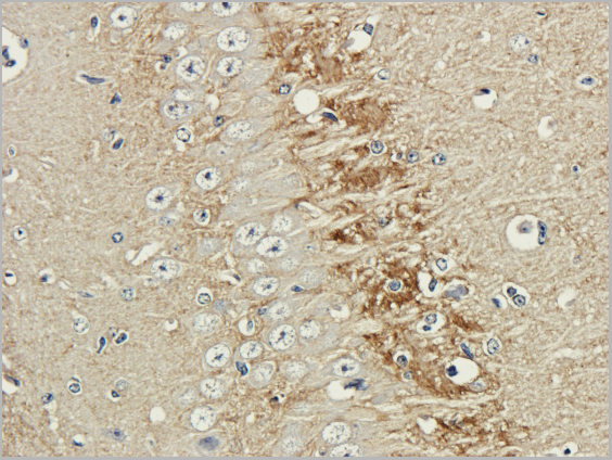 product-image-AAA14183_IHC.png