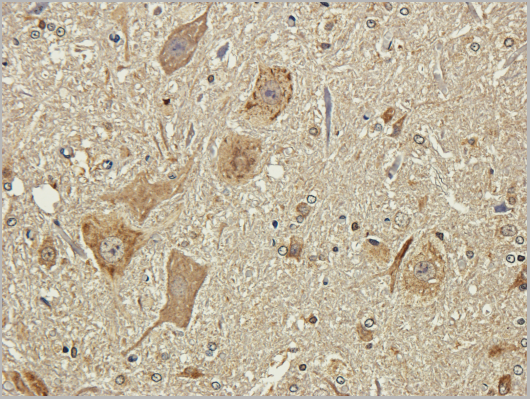 product-image-AAA14183_IHC2.png