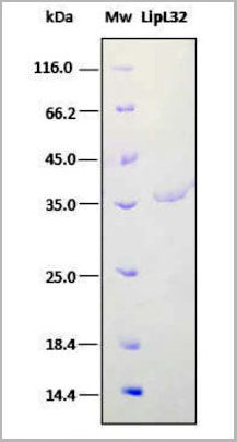 product-image-AAA14238_SDS_PAGE.jpg