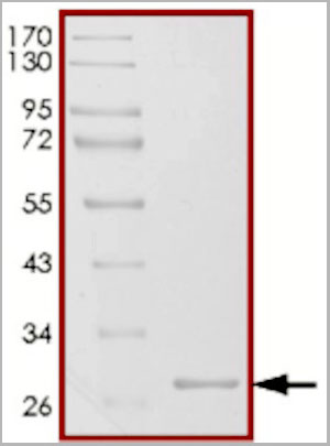 product-image-AAA14250_SDS_PAGE.jpg