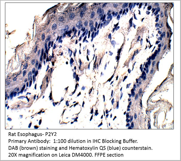 product-image-AAA14402_IHC.png