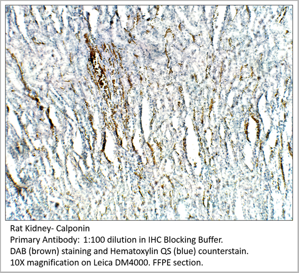 product-image-AAA14404_IHC.png