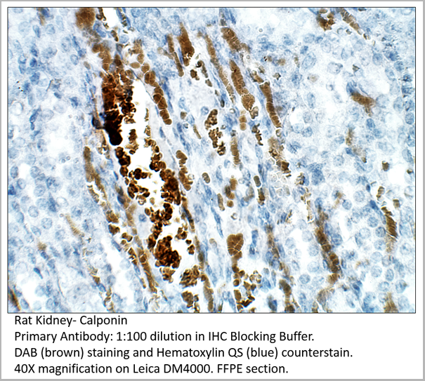 product-image-AAA14404_IHC2.png