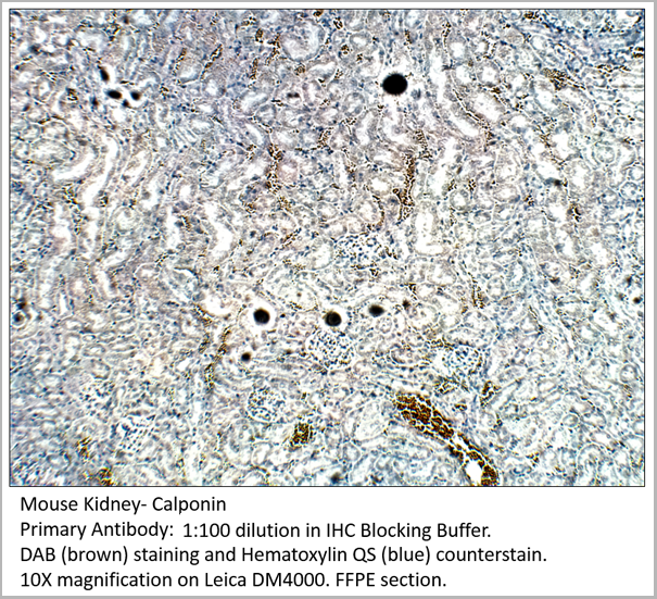 product-image-AAA14404_IHC3.png