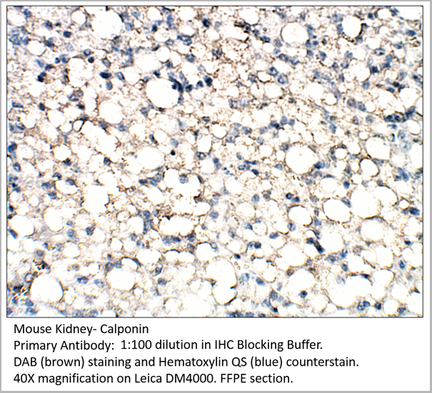 product-image-AAA14404_IHC4.png