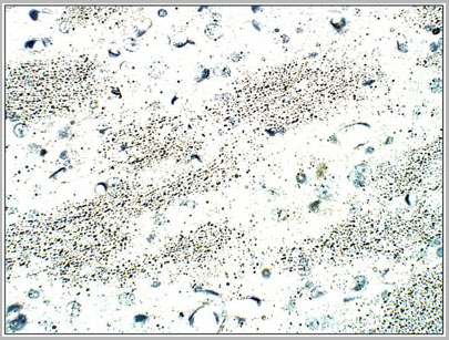 product-image-AAA14405_IHC.jpg