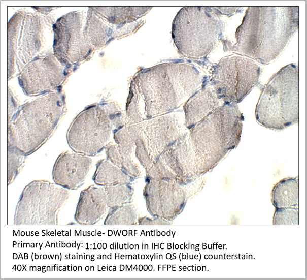 product-image-AAA14407_IHC.png