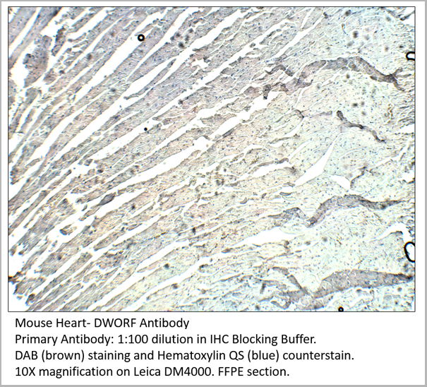 product-image-AAA14407_IHC2.png