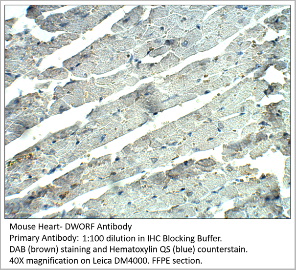 product-image-AAA14407_IHC3.png
