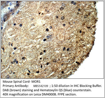 product-image-AAA14412_IHC.jpg