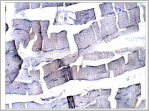 product-image-AAA14413_IHC2.jpg
