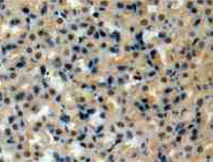 product-image-AAA145262_IHC11.gif