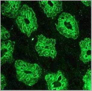 product-image-AAA14563_IHC2.jpg