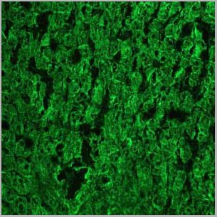 product-image-AAA14563_IHC3.jpg
