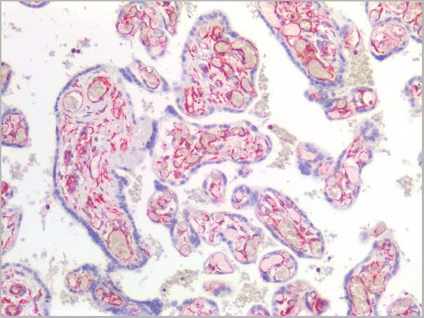 product-image-AAA14574_IHC4.jpg