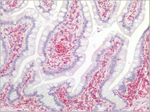 product-image-AAA14574_IHC8.jpg