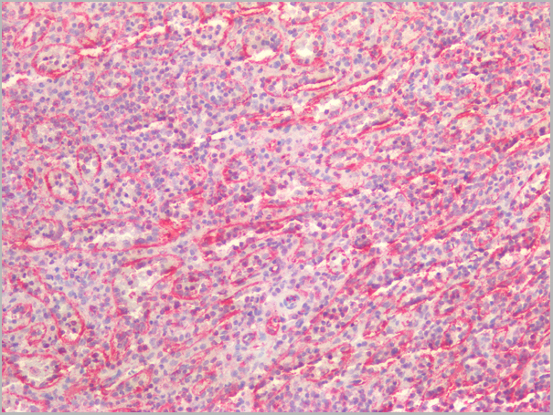 product-image-AAA14575_IHC3.jpg