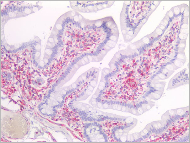 product-image-AAA14575_IHC4.jpg