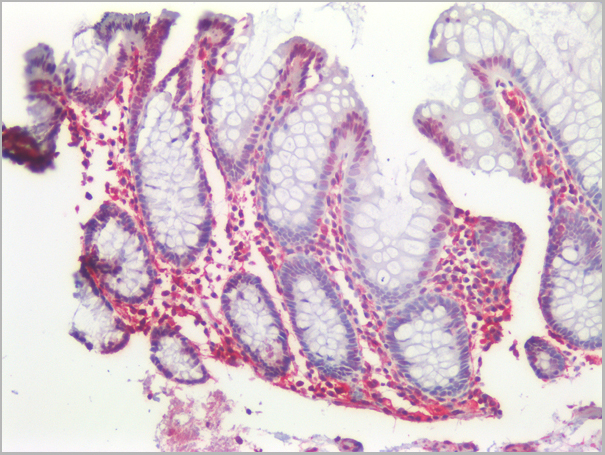 product-image-AAA14575_IHC6.jpg
