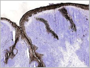 product-image-AAA14609_IHC2.jpg