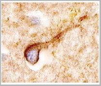 product-image-AAA14651_IHC.jpg