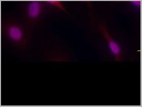 product-image-AAA14651_IHC2.jpg