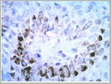 product-image-AAA14653_IHC.jpg